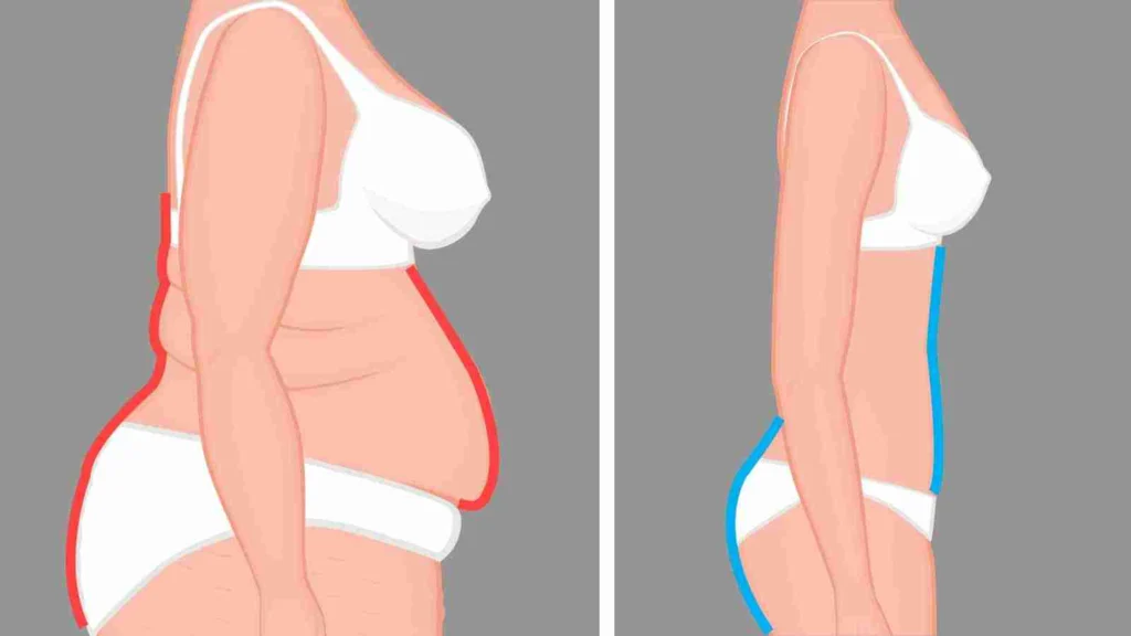 What Is Bulletproof Coffee? Complete Health Guide 7 Before and after weight loss illustration